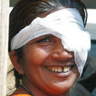 Eye op